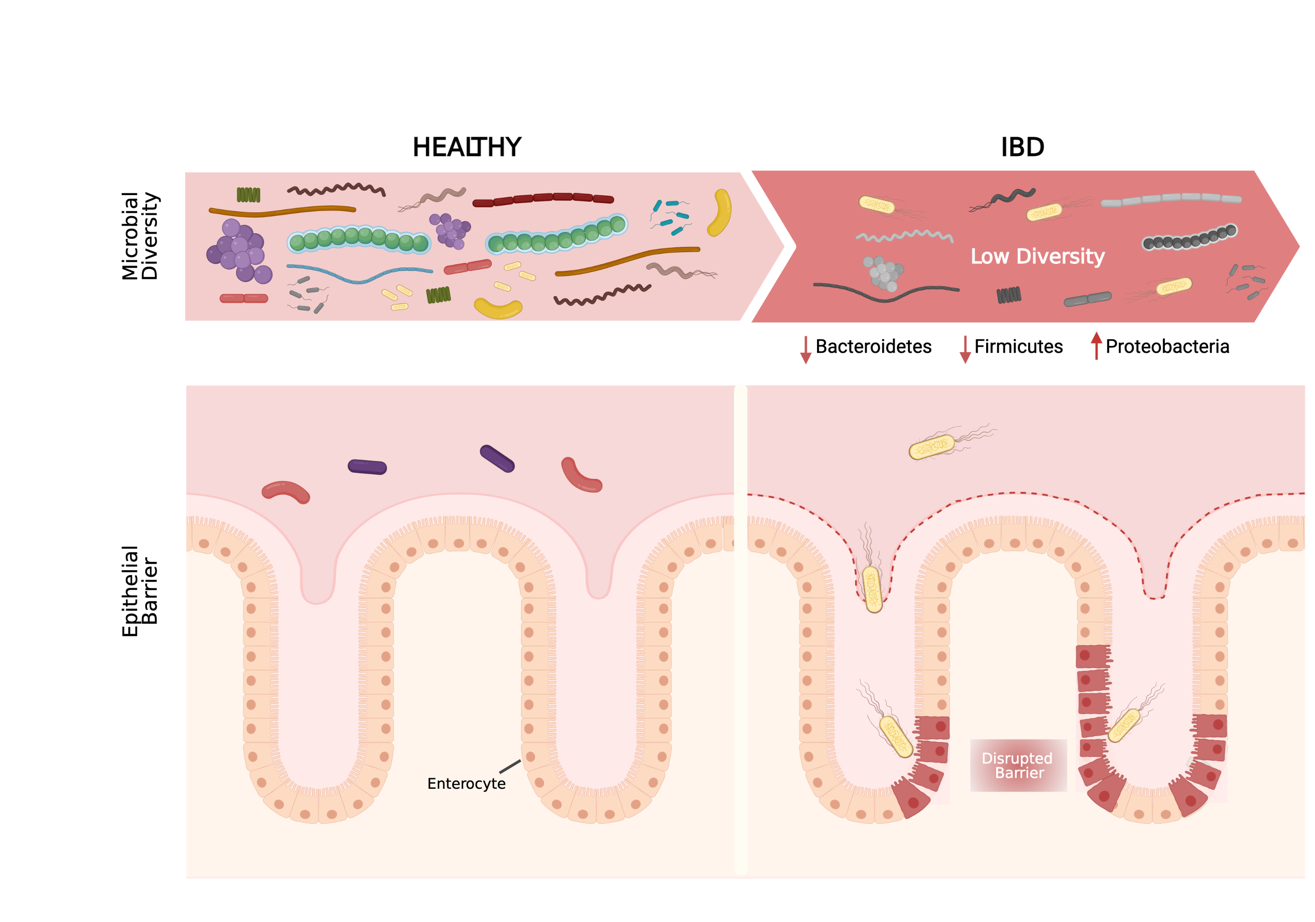The microbial composition in the gut. On the left healthy gut is represented as having a high microbiome diversity and no damage on the epithelial barrier. On the right the IBD gut were microbiome diversity is lower and some bacteria is in physical contact with the damaged epithelium. Adapted with permission from Mayorgas' 2021 thesis.